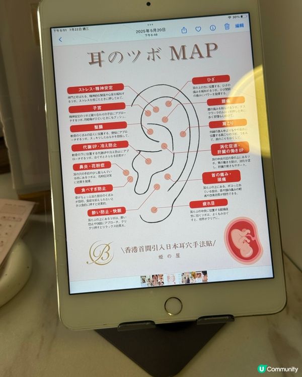 香港首間引入日本手法耳穴服務❤️