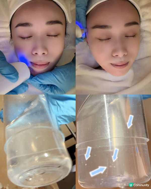 ✨ 尖沙咀美容私藏店💓【AttitudeBeauty】黑白松...