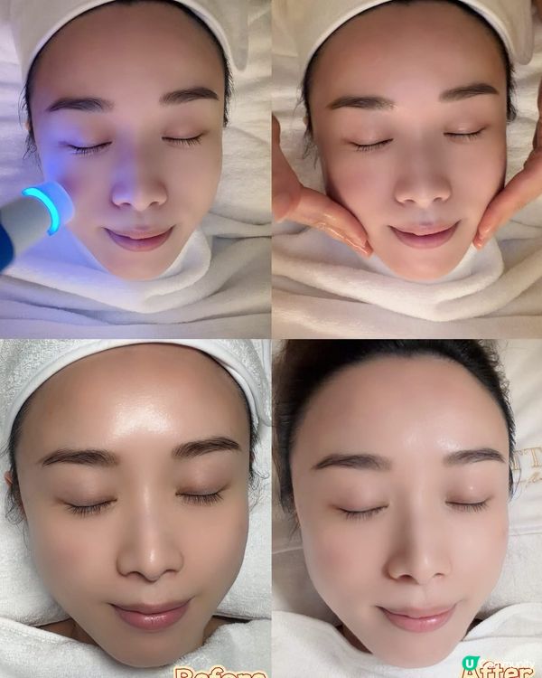 ✨ 尖沙咀美容私藏店💓【AttitudeBeauty】黑白松...