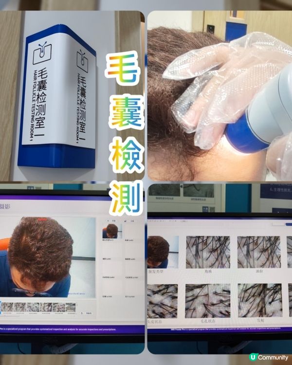 頭皮救星！甩髮油笠一掃空 💆‍♀️✨