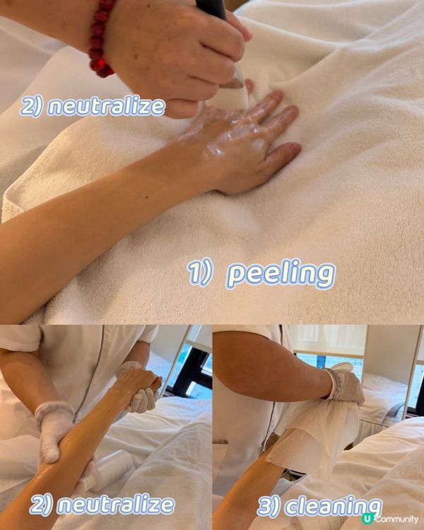 有尊屬美白雙手嘅treatment 啦🤍