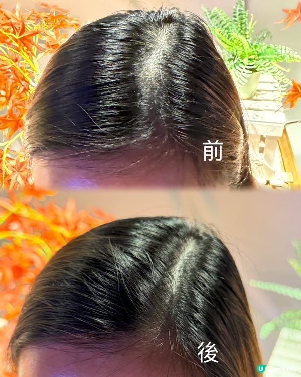 脫髮真係一個令人頭痛嘅問題,每日望住地上甩落嚟嘅頭髮,心情都...