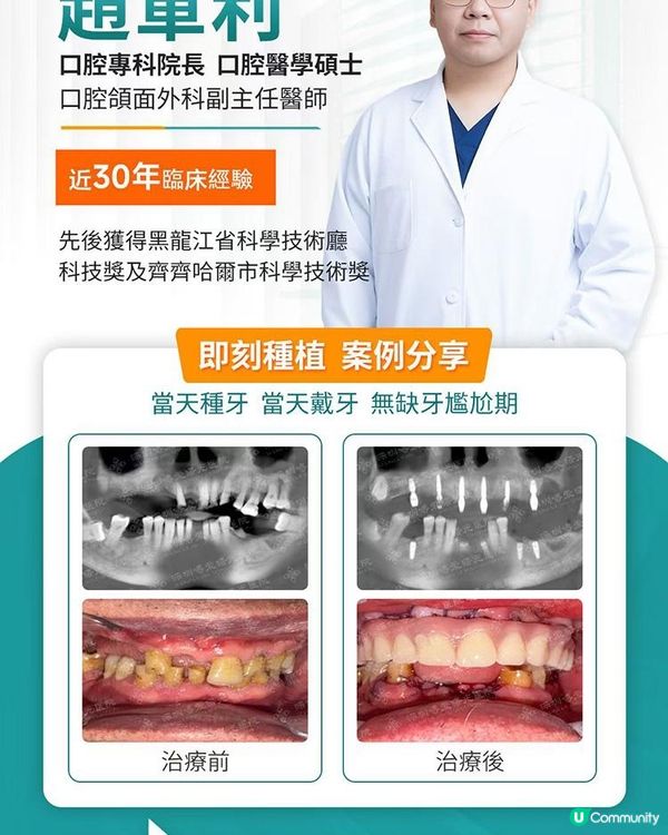 多牙鬆動點算好？即拔即種當日種牙當日戴牙真實個案