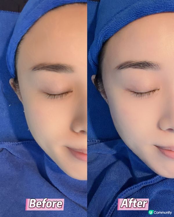 ✨ 旺角高質美容院!告別假肚腩 + 打造水光肌💖💆🏻‍♀️...
