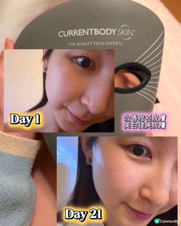 21日激變！💆‍♀️ 告別暗黃斑點✨