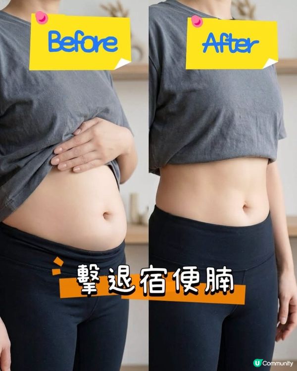 💩 甩走宿便假肚腩!告別『腸胃罷工』煩惱 ✨