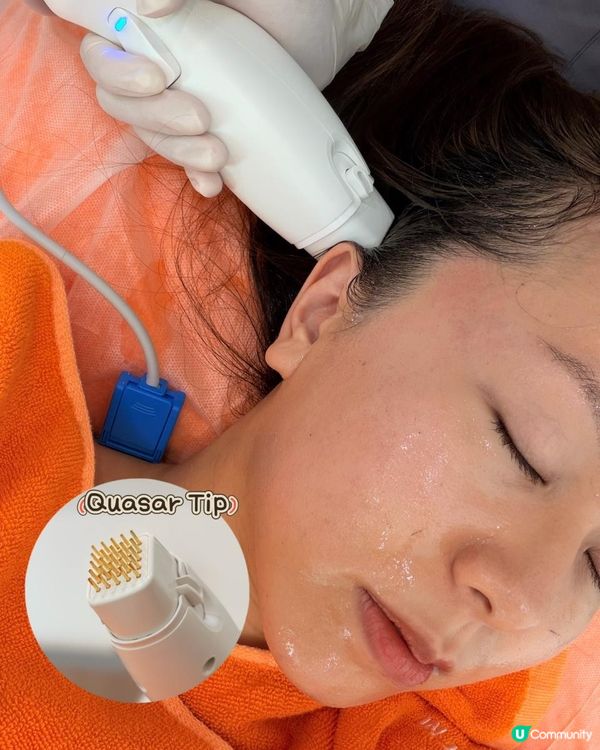 無創無痛膠原增生！MEDSKIN PLUS+ X SunnyRF 全方位提拉