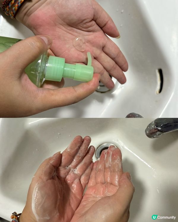 塊面易過敏同埋成日爆豆嘅手足入嚟！！😭