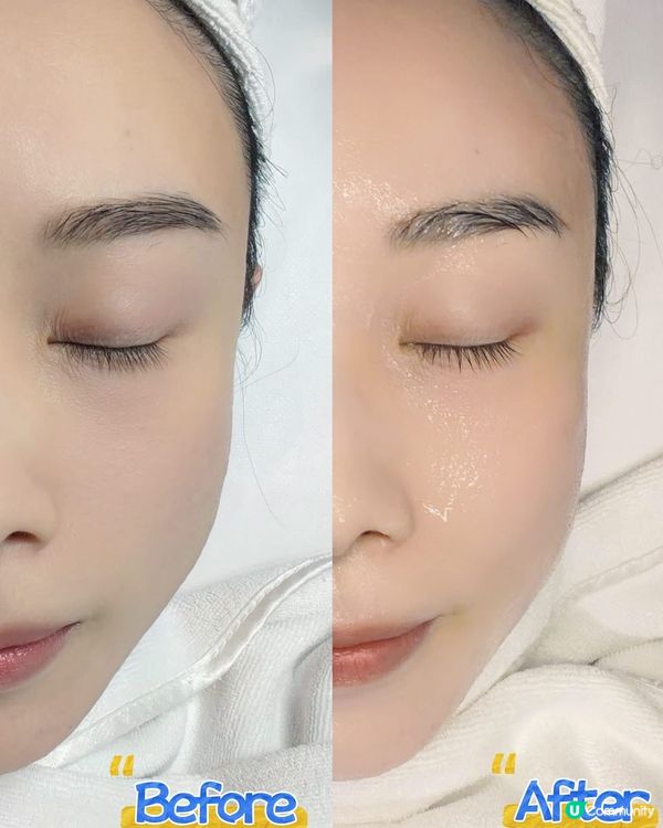 ✨尖沙咀隱世美容小店💓打造無瑕水光肌🧖🏻‍♀️