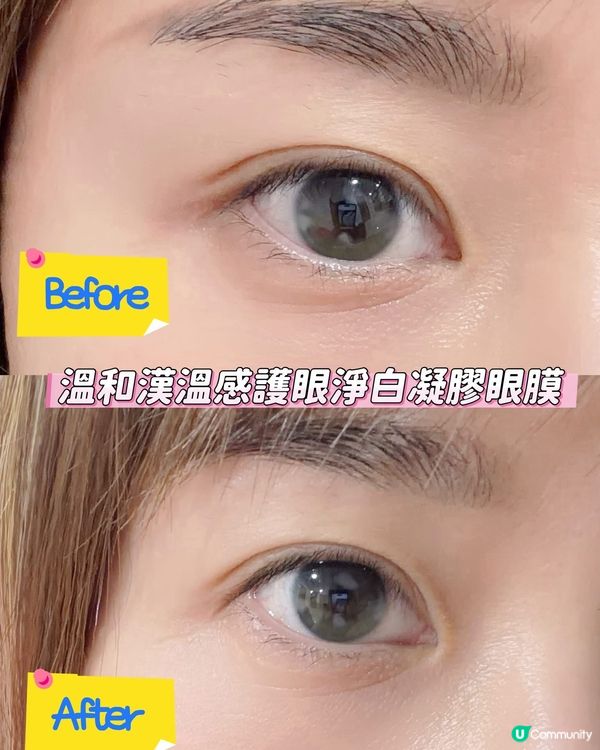 夏日要著比基尼､細肩帶💁🏻‍♀️如出現私密處同腋下嘅暗沉,真...