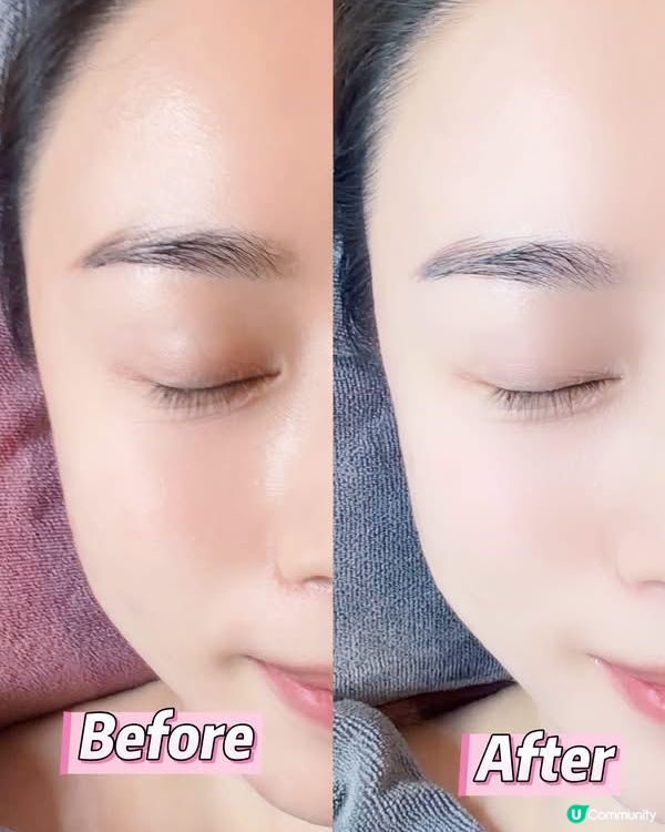 ✨ 【零痛感･瞬間小顏急救‼️】荃灣 WY Beauty ｢...