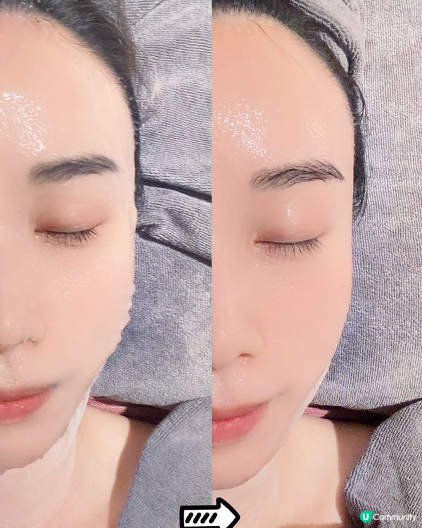 ✨ 【零痛感･瞬間小顏急救‼️】荃灣 WY Beauty ｢...