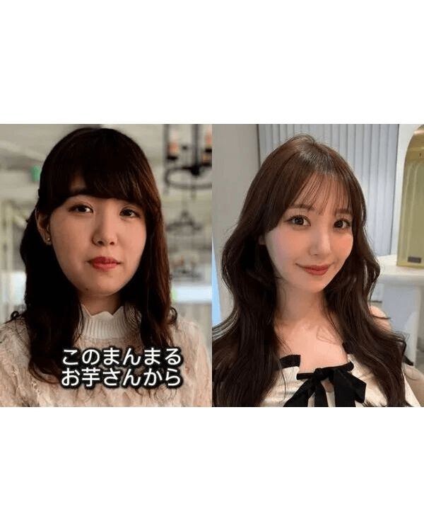 日本護士花10年整容減肥逆襲成女神😮使40萬抽脂惹熱議💬稱要整到無猶豫為止❗️
