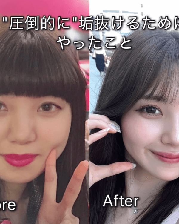 日本護士花10年整容減肥逆襲成女神😮使40萬抽脂惹熱議💬稱要整到無猶豫為止❗️