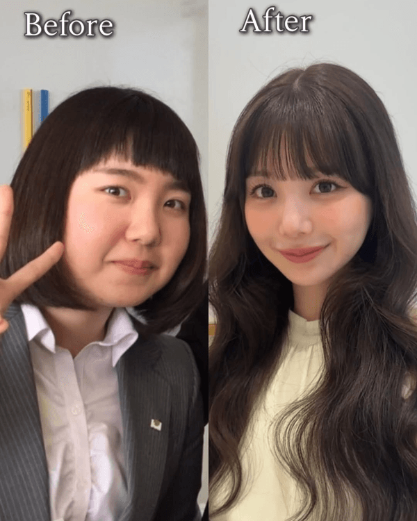 日本護士花10年整容減肥逆襲成女神😮使40萬抽脂惹熱議💬稱要整到無猶豫為止❗️