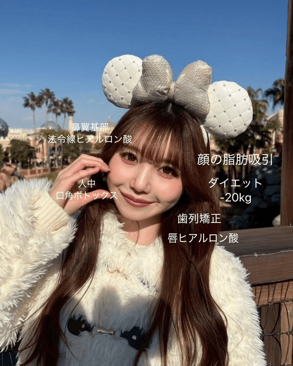 日本護士花10年整容減肥逆襲成女神😮使40萬抽脂惹熱議💬稱要整到無猶豫為止❗️