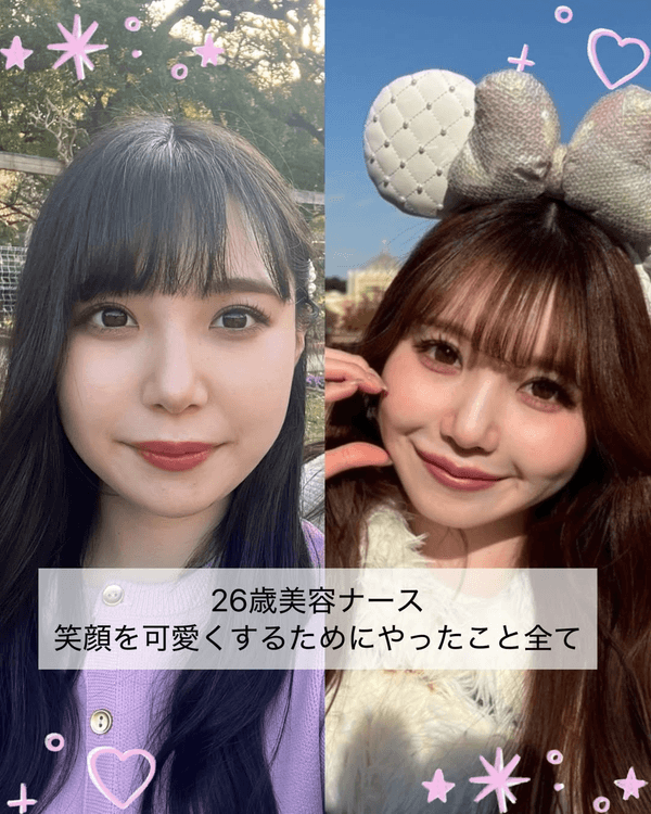 日本護士花10年整容減肥逆襲成女神😮使40萬抽脂惹熱議💬稱要整到無猶豫為止❗️