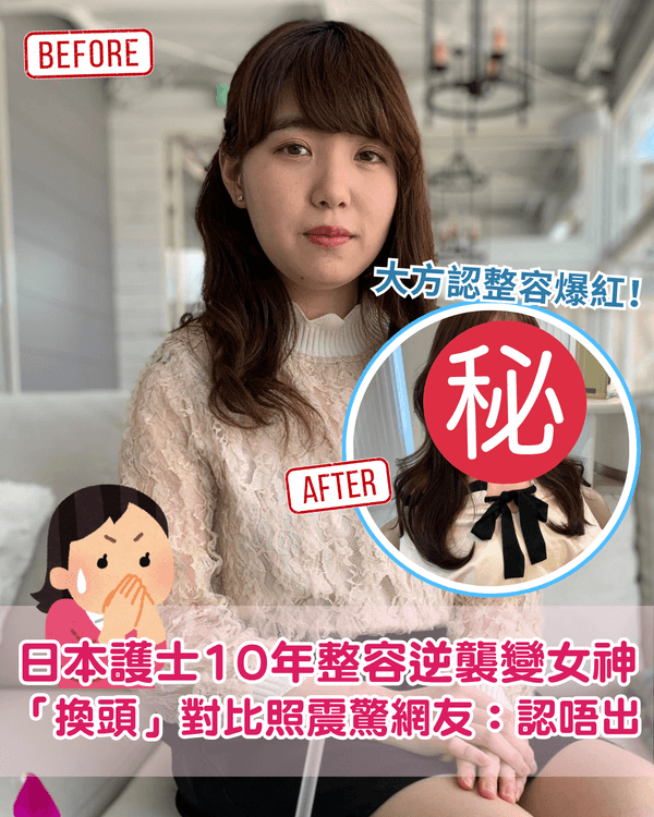 日本護士花10年整容減肥逆襲成女神😮使40萬抽脂惹熱議💬稱要整到無猶豫為止❗️