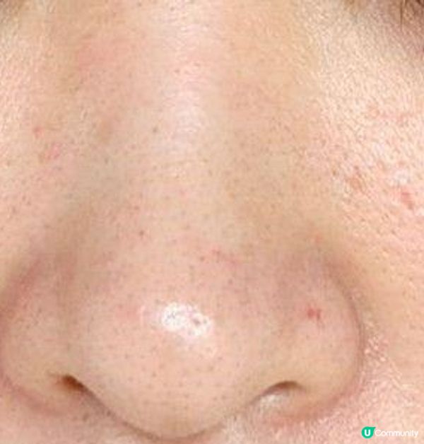 乾肌人士的秋冬保濕神器~冰冰針