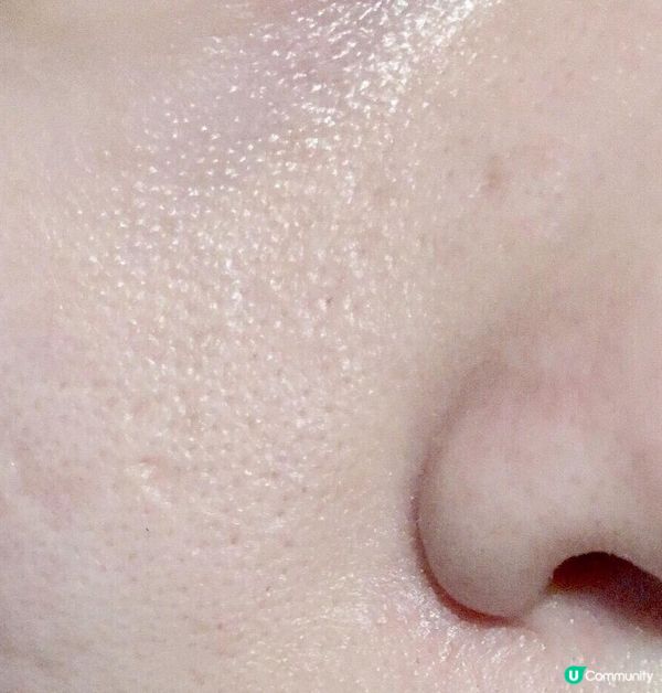 乾肌人士的秋冬保濕神器~冰冰針