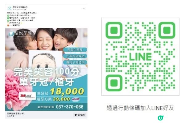 苗栗法院對面植牙推薦牙醫－品悅牙醫李明宗醫師細心治療｜母親節帶媽媽做微創植牙手術傷口小，大幅減少植牙手術時間