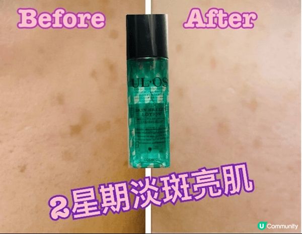 我年紀愈大色斑愈深，色斑問題真係令我好顯老😢加上我又係油性皮...