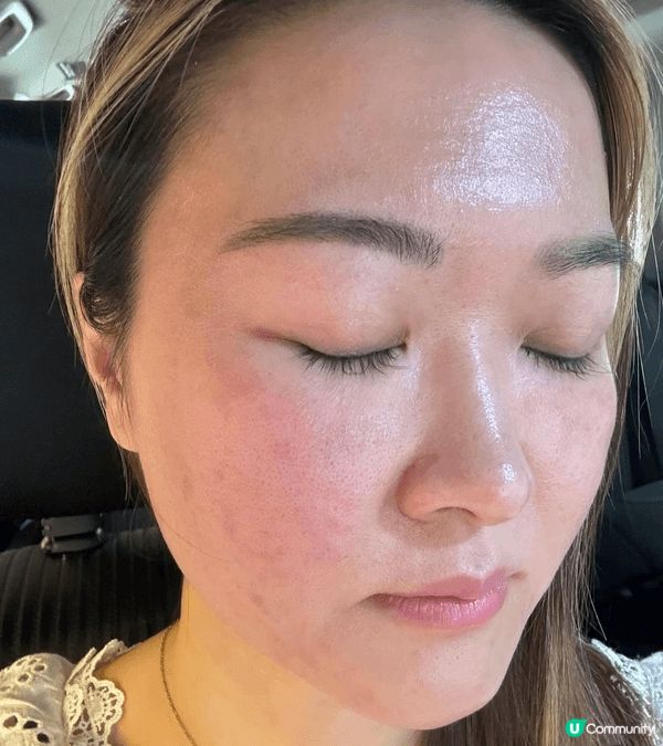 ✨💁‍♀️ 肌膚救星現身！
