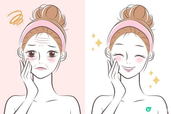 想緊膚提拉，Thermage Flx vs HIFU點揀好？