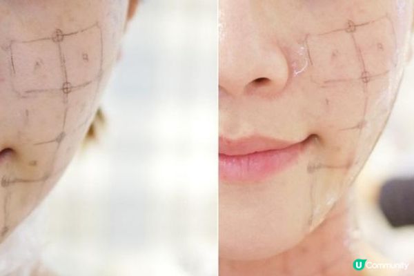 想緊膚提拉，Thermage Flx vs HIFU點揀好？