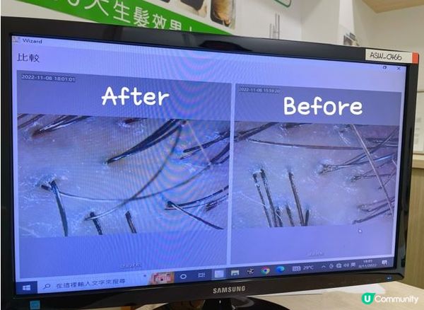 【改善脫髮】生髮中心推薦｜詳細活髮療程大公開！