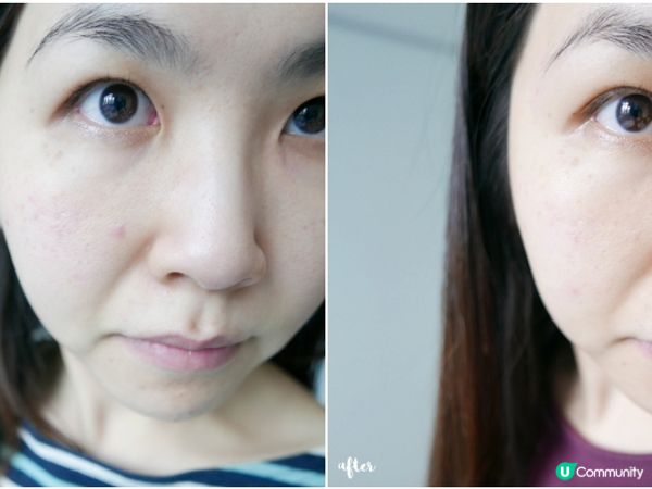 【22%OFF 優惠碼】英國直送美肌保健產品☘ Naturecan Fitness