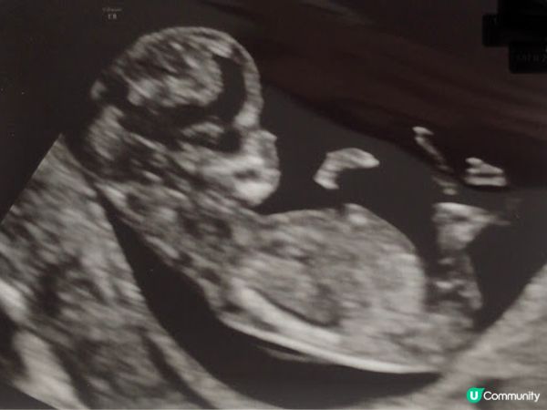 [英國懷孕記21/22] 我的孕初期 迎來了小生命 Week 1 - Week 12