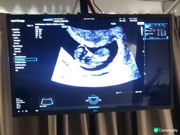 二寶懷孕記錄❤️ Week 1 to Week 30