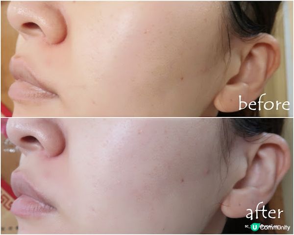 Lancôme Génifique 小黑瓶 ❤ 重拾肌膚透亮感話咁易！！