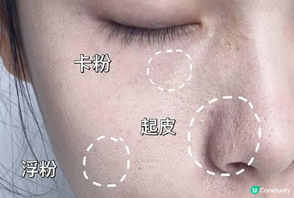 夏天溶妝好尷尬！一溶妝秒變斑點狗……