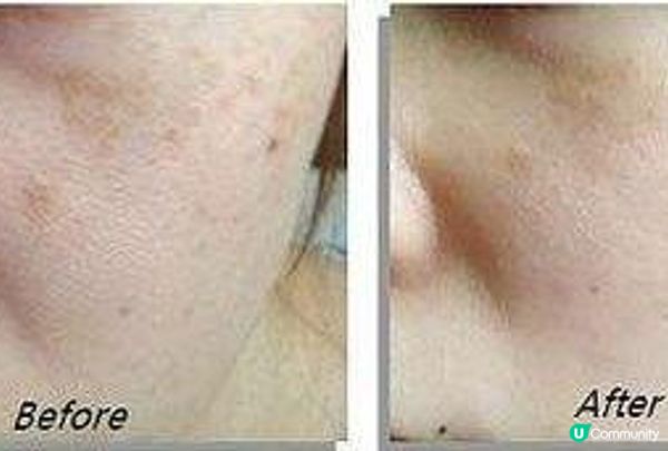 夏天溶妝好尷尬！一溶妝秒變斑點狗……