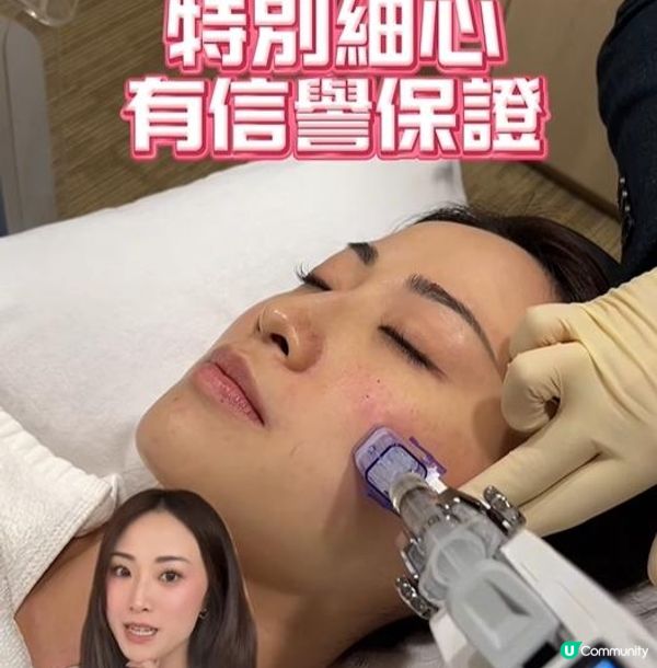 做完水光針皮膚真係靚左好多，又保濕又收毛孔! KOL Madcouple親試完話……