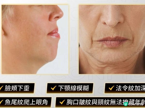 香港多靚女？港女識打扮又係真嘅，尤其係而家醫美當道！