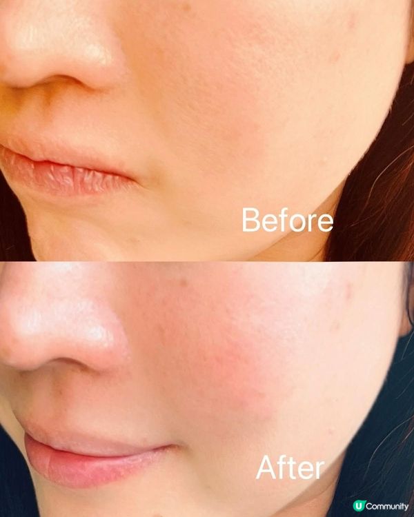 ✨MyLover‘s 黃金逆齡複合活性精華液✨