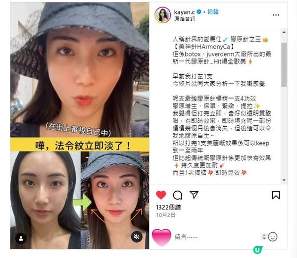 HarmonyCa美神針係咩來頭？連Kayan C都甘拜下風？