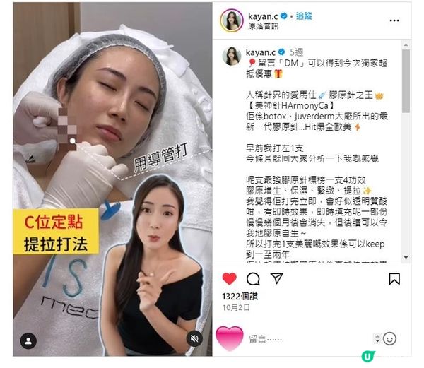 HarmonyCa美神針係咩來頭？連Kayan C都甘拜下風？