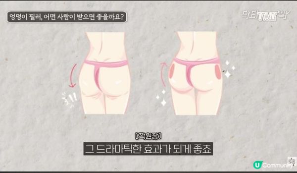 告別扁塌與假胯寬！專屬你的「完美臀部填充」，讓性感曲線立刻重生 🍑