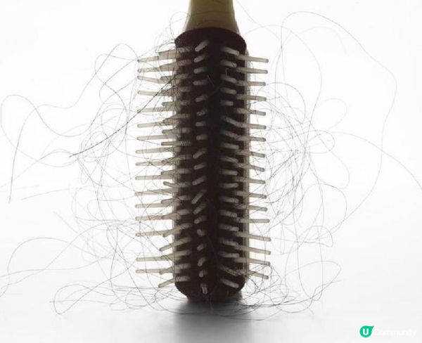 Exosome外泌體生髮係咩嚟？真係咁有效？