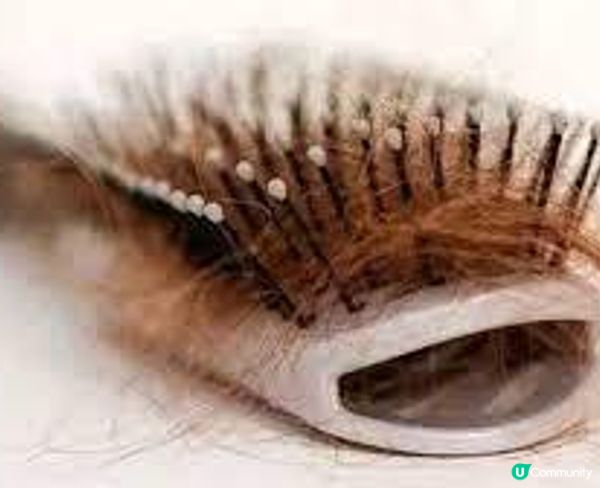 Exosome外泌體生髮係咩嚟？真係咁有效？