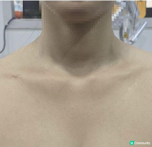🛑 救命呀！明明好瘦，穿吊帶衫一秒變「大隻妹」？原來你少了一條神仙鎖骨線！