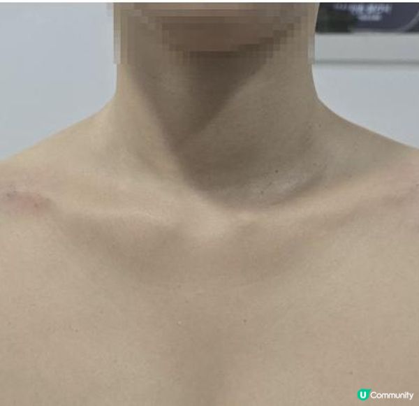 🛑 救命呀！明明好瘦，穿吊帶衫一秒變「大隻妹」？原來你少了一條神仙鎖骨線！
