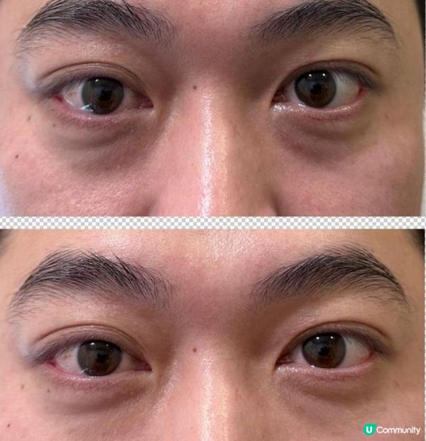 感謝miracle 18拯救左我老公既眼袋