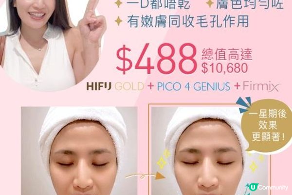 香港HIFU最新科技 HIFU GOLD 黃金索你試咗未？