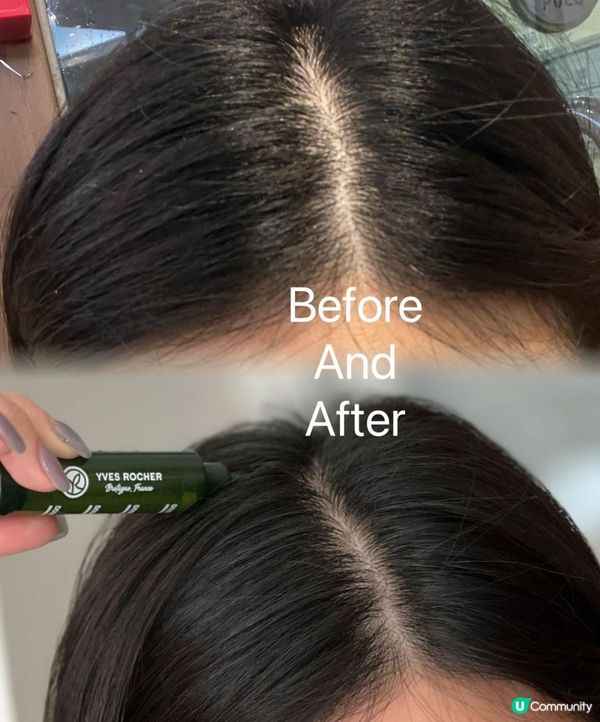 我的養髮生髮孖寶💕