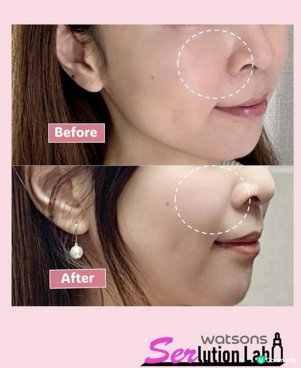 【DERMA LAB 粉紅救兵精華1+1💂🏻‍♀️】